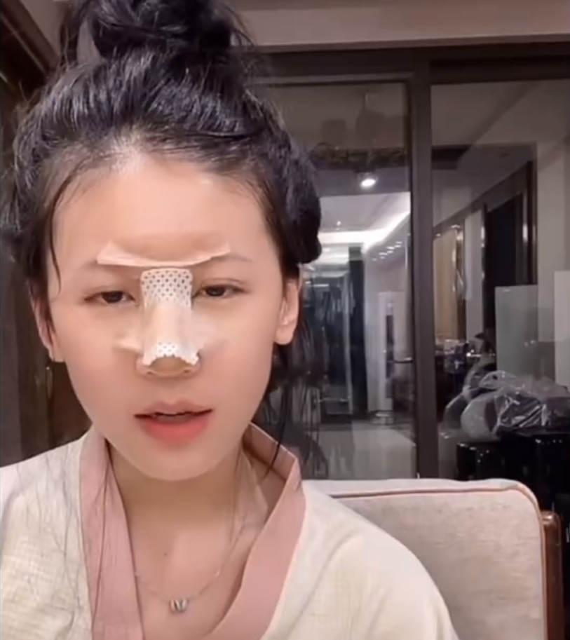 小炸串做完鼻子拆线,网友吐槽太丑了!宇文泡内涵某主播假想敌!(图2)