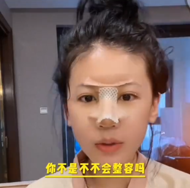 小炸串做完鼻子拆线,网友吐槽太丑了!宇文泡内涵某主播假想敌!(图4)