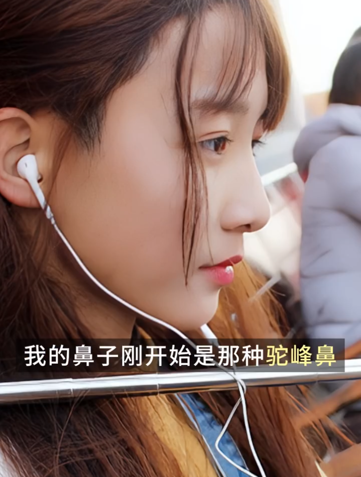 脸部前后60次“修改”，变性网红艾比分享整容经历，还是以前好看(图5)