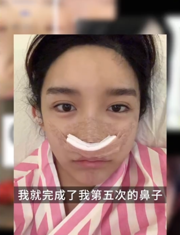 脸部前后60次“修改”，变性网红艾比分享整容经历，还是以前好看(图7)