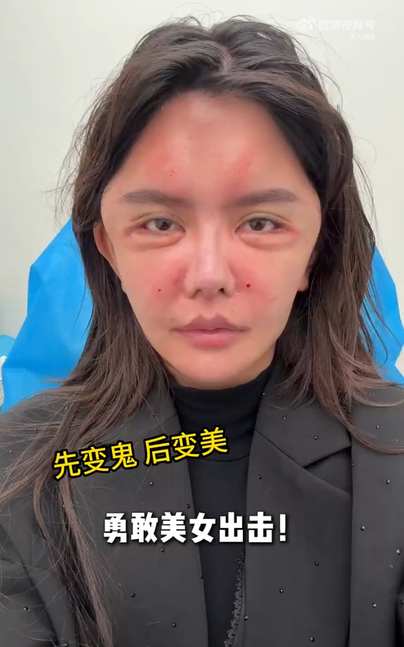 韩安冉N次整容后晒无美颜照，网友调侃：这不是“申公豹”吗？(图1)