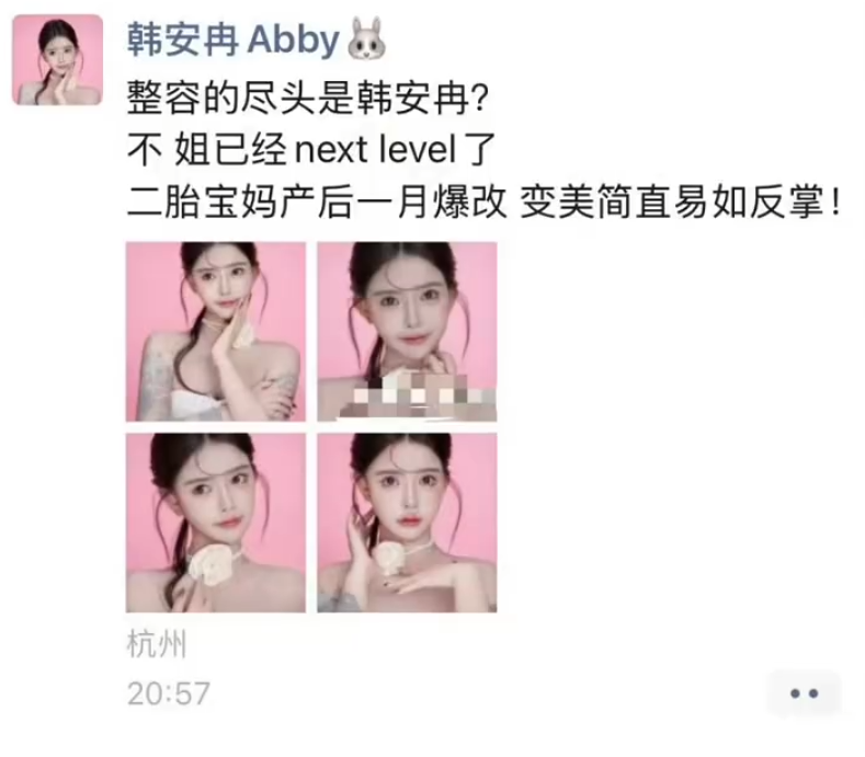 韩安冉产后一月就整容,大方晒出打针后的照片,整个脸都变形了(图2)