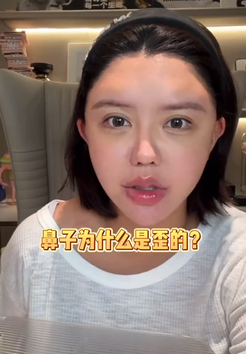 韩安冉产后一月就整容,大方晒出打针后的照片,整个脸都变形了(图4)