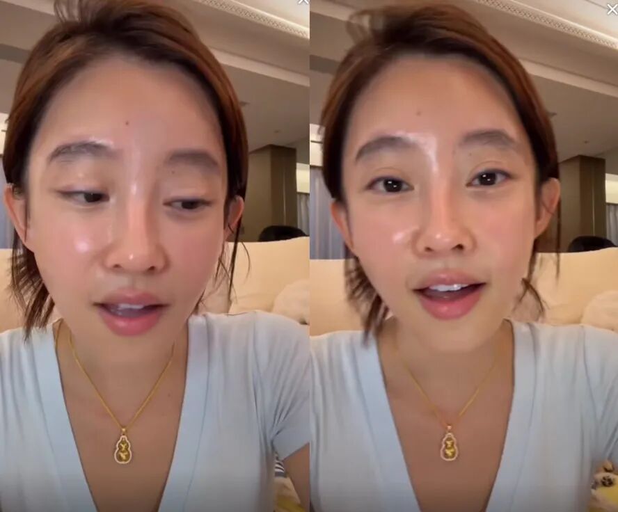 一毛钱的面膜敢用吗，我就敢！冯提莫讲述因捡便宜变成“激素脸”(图3)