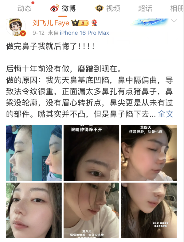 刘飞儿发文后悔整容？十年心结一朝解，坦言后悔没早去做鼻子(图2)