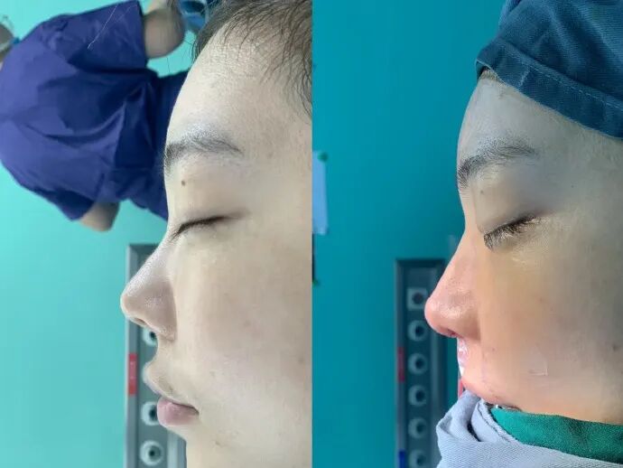 刘飞儿发文后悔整容？十年心结一朝解，坦言后悔没早去做鼻子(图3)