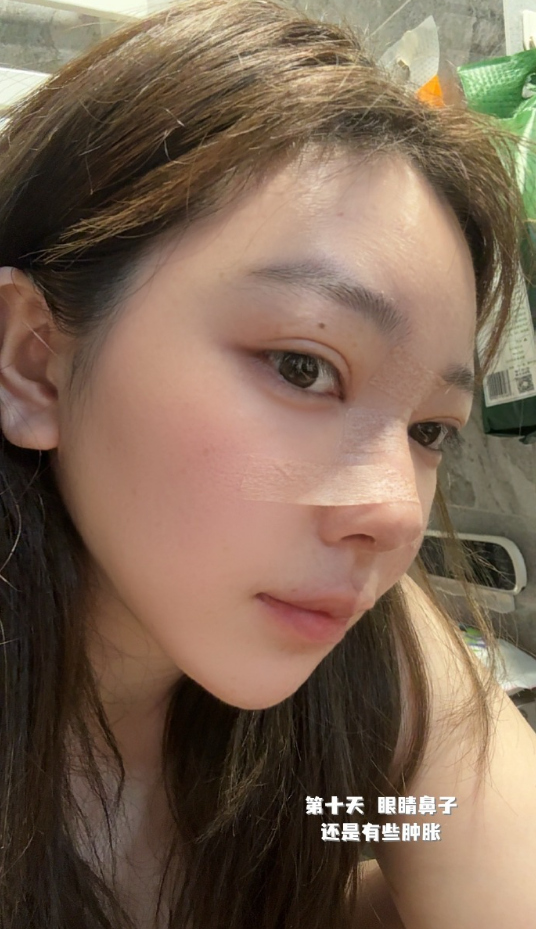 刘飞儿发文后悔整容？十年心结一朝解，坦言后悔没早去做鼻子(图6)