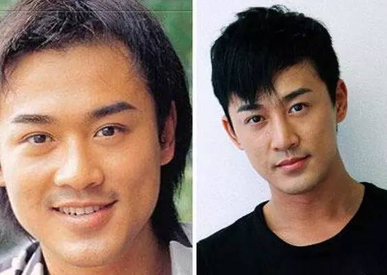 打死也不承认！那些娱乐圈整容到面瘫的男星(图2)