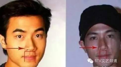 打死也不承认！那些娱乐圈整容到面瘫的男星(图4)