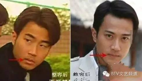 打死也不承认！那些娱乐圈整容到面瘫的男星(图5)