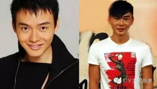 打死也不承认！那些娱乐圈整容到面瘫的男星(图7)