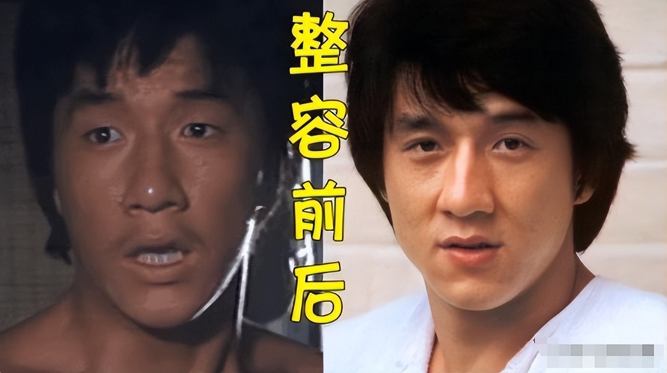 真的没整？靠整容翻身的5位男星，出道前后差距太大你知道吗(图2)