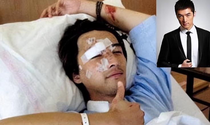 真的没整？靠整容翻身的5位男星，出道前后差距太大你知道吗(图12)