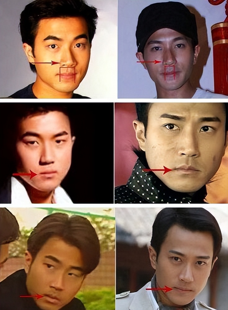 真的没整？靠整容翻身的5位男星，出道前后差距太大你知道吗(图6)