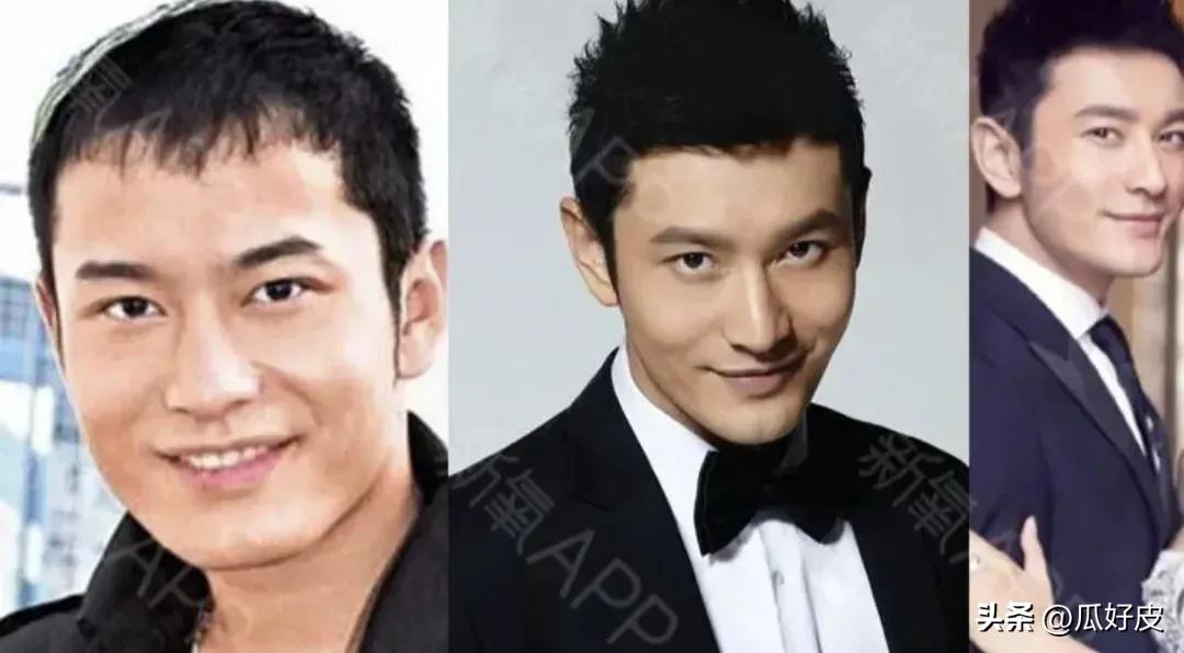 靠整容整得火出圈的5位男明星(图2)