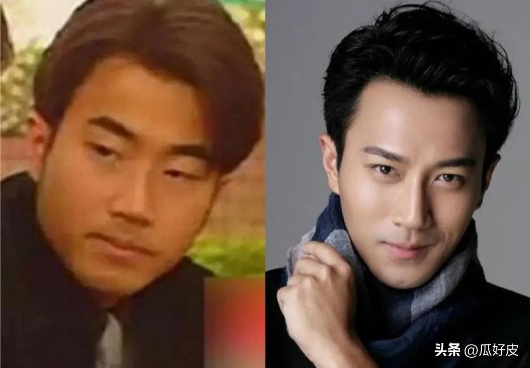 靠整容整得火出圈的5位男明星(图3)
