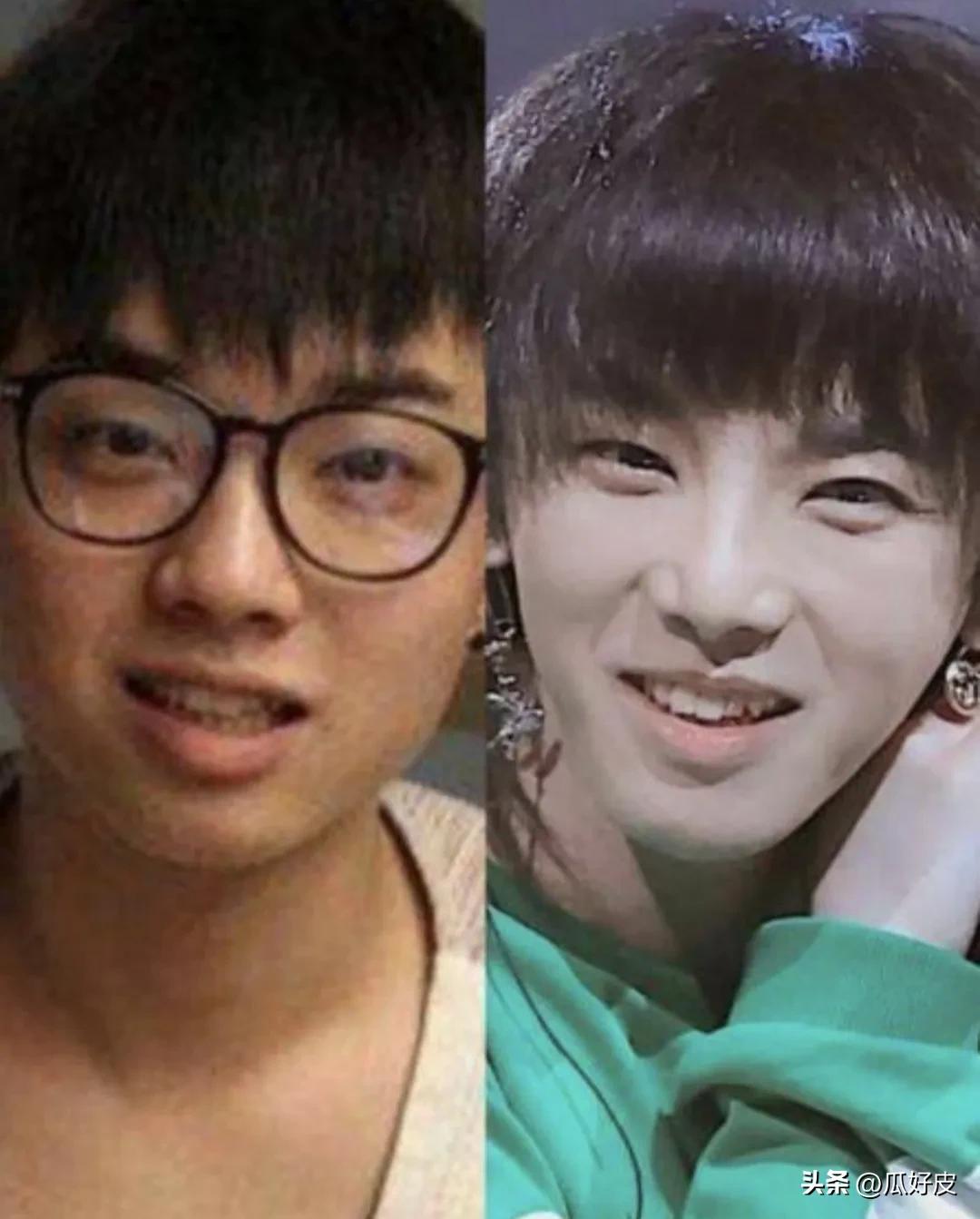 靠整容整得火出圈的5位男明星(图4)