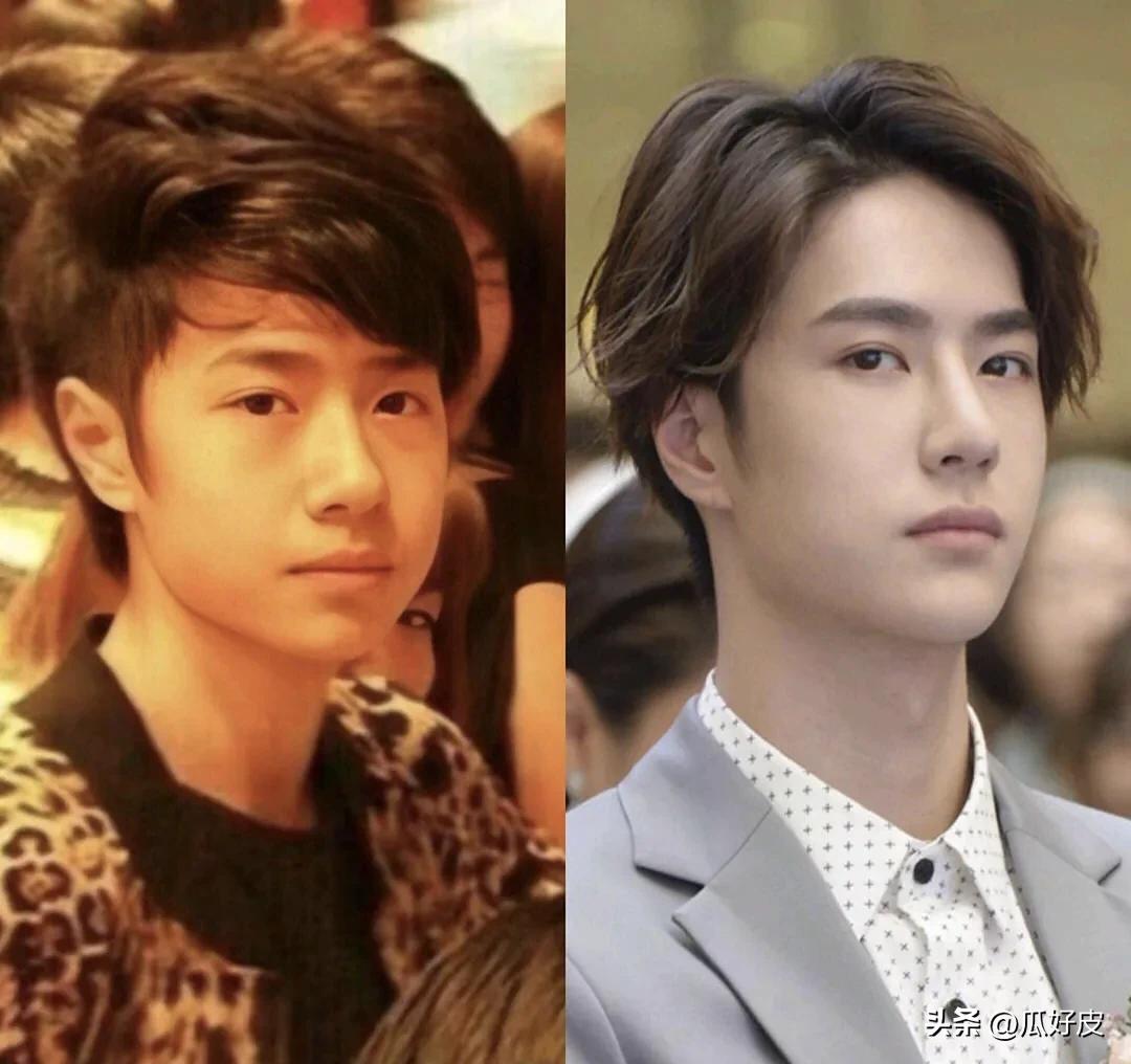 靠整容整得火出圈的5位男明星(图5)