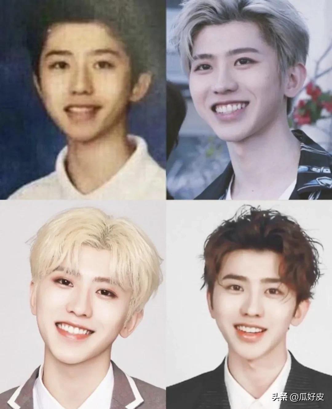 靠整容整得火出圈的5位男明星(图6)