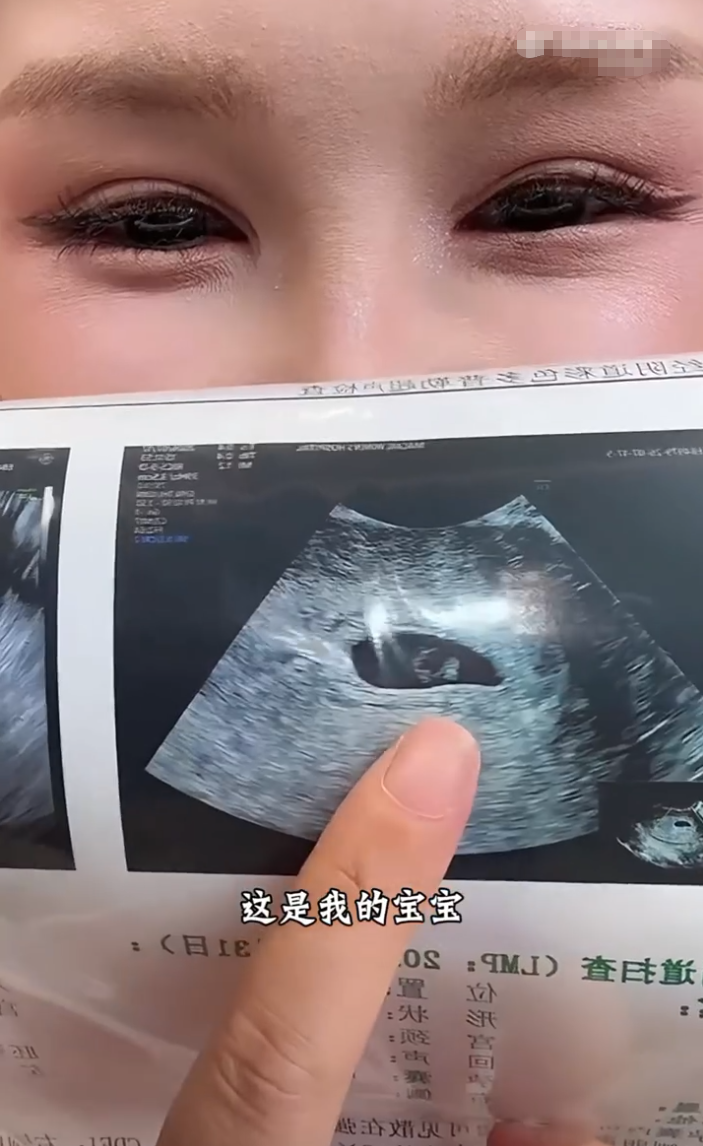何婧婧自曝怀孕八周，刘一手发歌《爱你太多》，董莹莹回应“从此再无交集”？(图3)